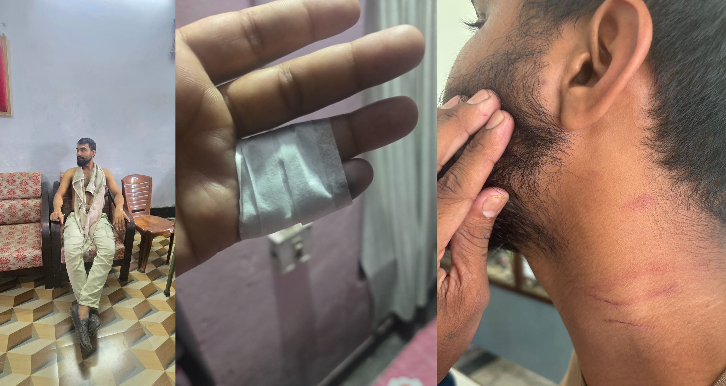 मोरङ क्याम्पसमा फेरि कुटिए विद्यार्थी, नेविसंघ माथि लाग्यो आरोप