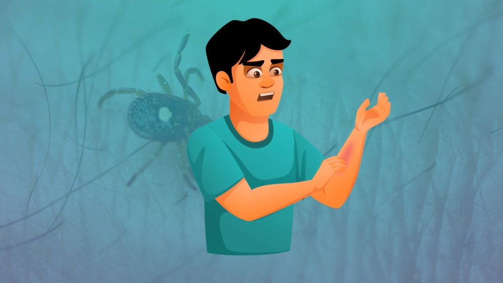 गर्मीमा लामखुट्टे, भुसुना, किर्नाबाट कसरी सजग रहने ?